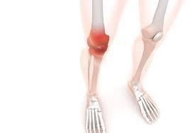 膝屈伸時の膝痛に足首が影響している？